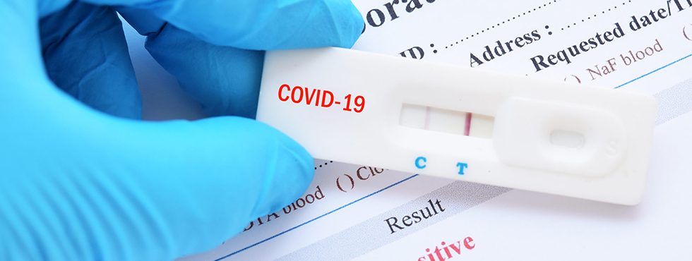 Быстрый экспресс-тест для диагностики COVID-19